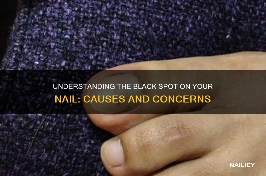 what is the black spot on my nail
