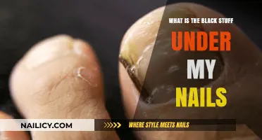 Understanding the Black Stuff Under Your Nails: Causes and Solutions