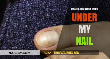 Understanding the Black Spot Under Your Nail: Causes and Solutions
