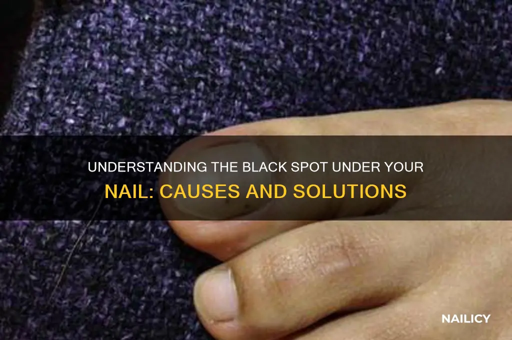 what is the black thing under my nail