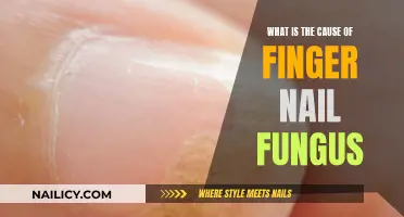 Fungal Infections: Understanding the Cause of Finger Nail Fungus