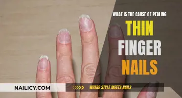 Unraveling the Mystery: Why Your Nails Peel and Thin