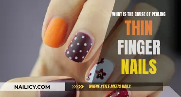 Thin Nails: Why They Peel and How to Fix Them