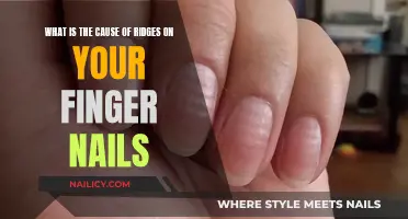 Unraveling the Mystery: Why Your Nails Form Ridges