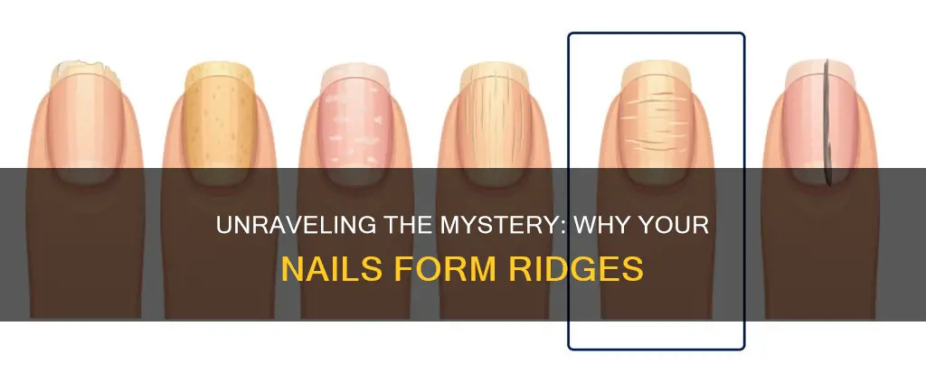 what is the cause of ridges on your finger nails