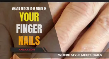 The Mystery of Ridges on Fingernails: What's the Cause?