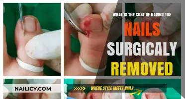Toe Nail Removal: Surgical Cost Explained