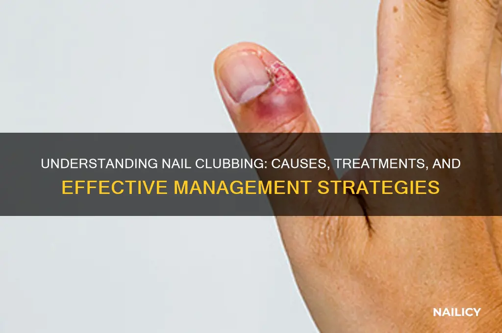 what is the cure for nail clubbing