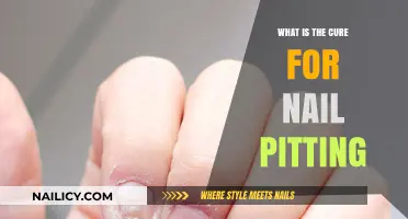 Effective Treatments for Nail Pitting: Causes, Solutions, and Prevention Tips