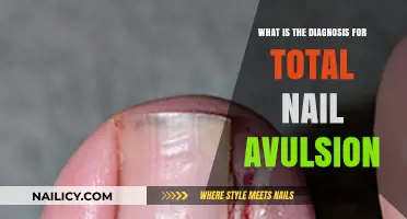 Understanding Total Nail Avulsion: Diagnosis, Treatment, and Recovery Explained