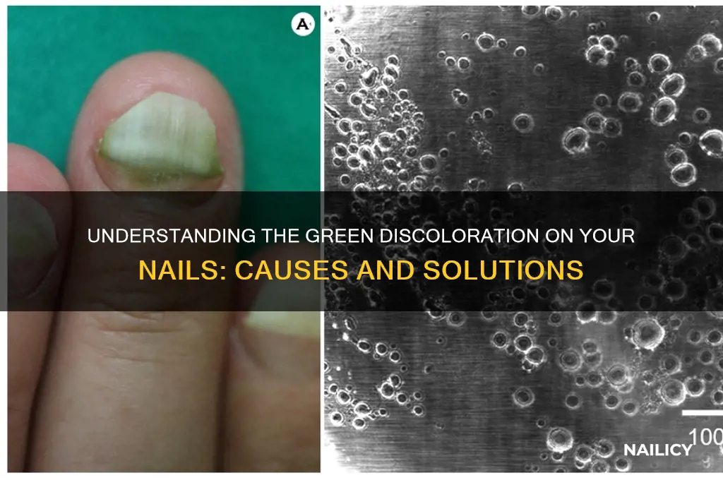 what is the green on my nail