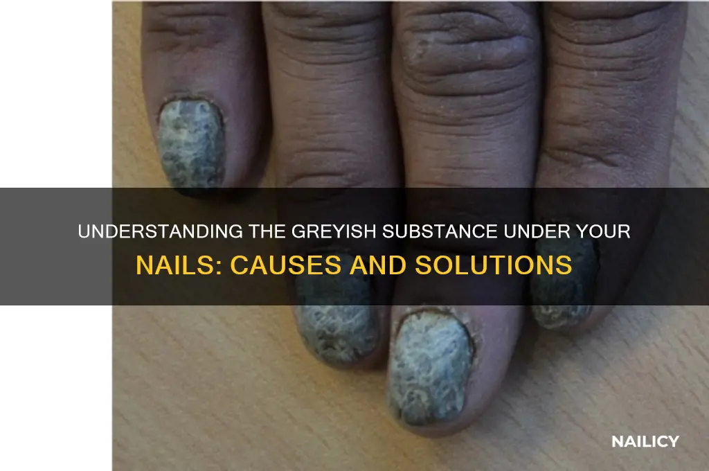 what is the greyish stuff under your nails