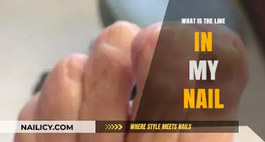 Understanding the Line in Your Nail: Causes and Concerns Explained