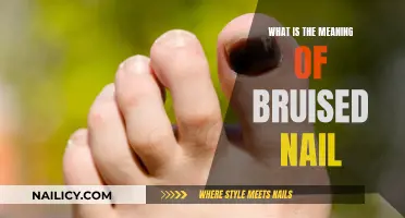 The Mystery of Bruised Nails: What Do They Mean?