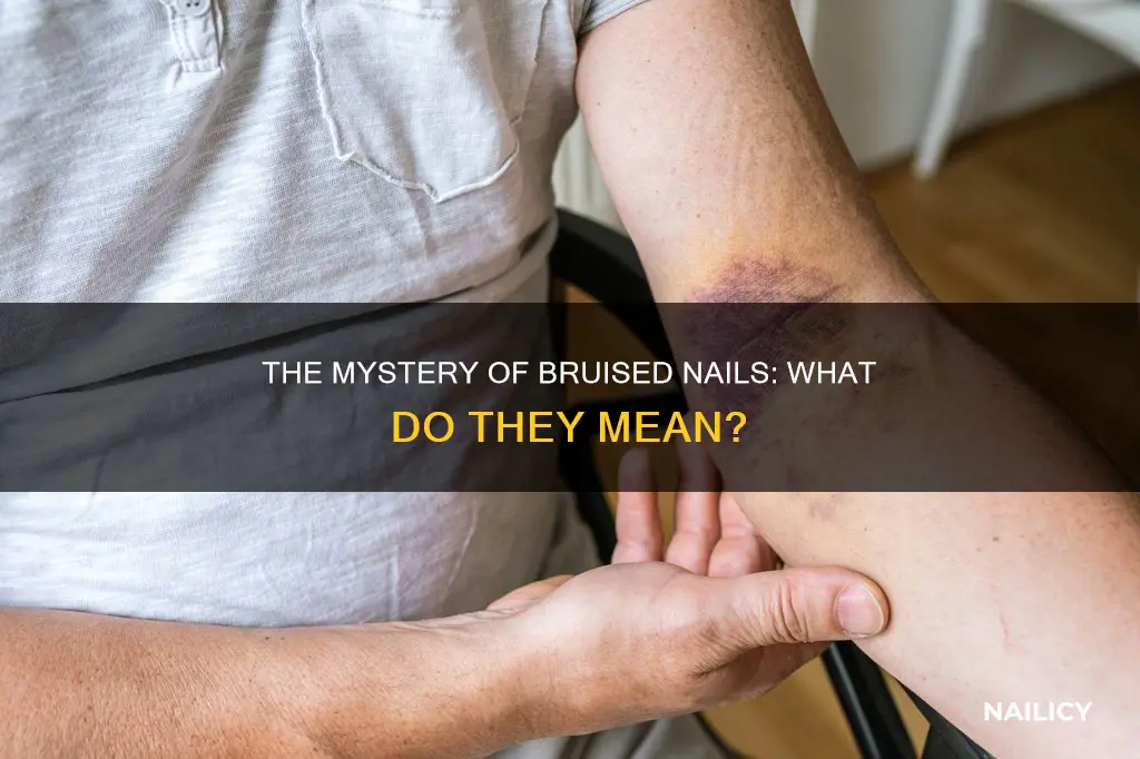 what is the meaning of bruised nail