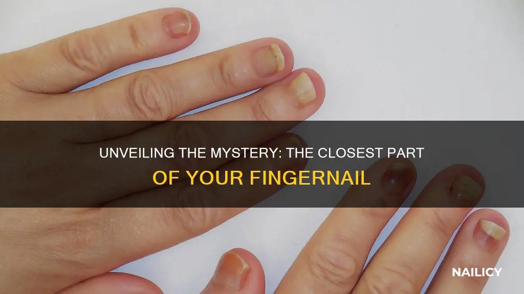 what is the most proximal part of a finger nail