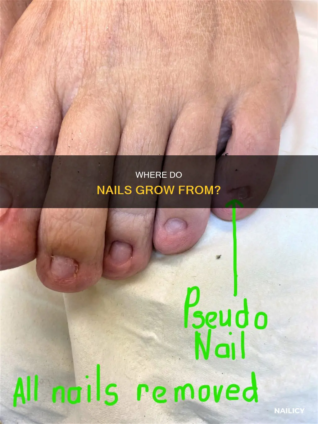 what is the nail growing spot