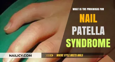 Understanding Nail Patella Syndrome: Prognosis, Management, and Quality of Life