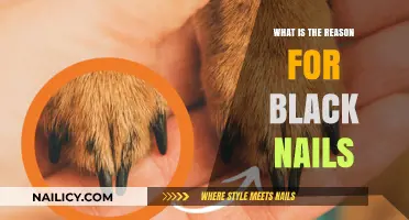 Why Black Nails? Uncovering the Causes and Concerns