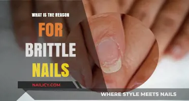 Brittle Nails: Uncovering Causes and Solutions for Stronger, Healthier Nails
