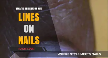 Unveiling the Mystery: Why Do Lines Appear on Your Nails?