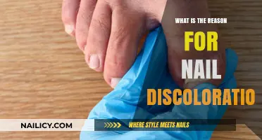 Understanding Nail Discoloration: Causes and Solutions for Healthy Nails