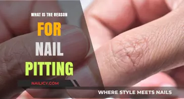 Understanding Nail Pitting: Causes, Symptoms, and Treatment Options Explained