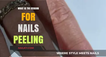 Why Do Nails Peel? Causes and Solutions for Brittle Nails