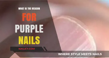 Why Are My Nails Purple? Causes and Concerns Explained