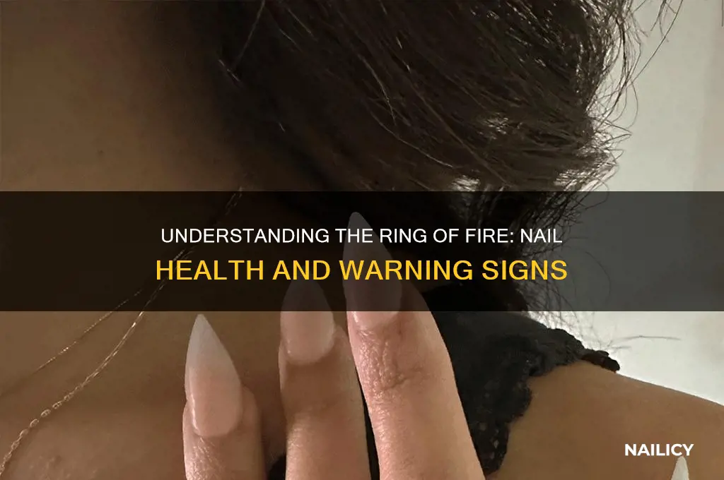 what is the ring of fire on nails