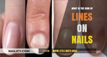 Lines on Nails: Understanding Their Meaning and Health Implications