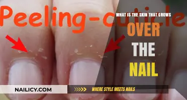 The Skin Over Nails: What's It Called?