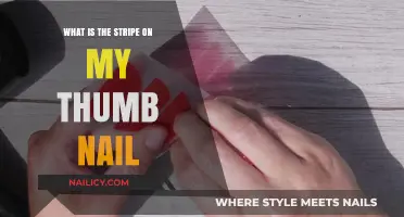 Understanding the Mysterious Stripe on Your Thumb Nail: Causes and Insights