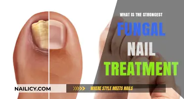 Effective Fungal Nail Treatment: Discover the Strongest Solution for Healthy Nails