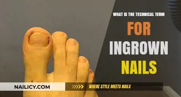 Understanding Onychocryptosis: The Medical Term for Ingrown Nails Explained