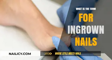 Understanding Ingrown Nails: The Medical Term and Its Implications