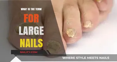 Understanding Onychoauxis: The Medical Term for Large Nails Explained