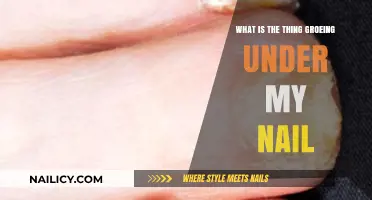 Unsightly Nail Growth: Identifying and Treating the Mystery Under Your Nail