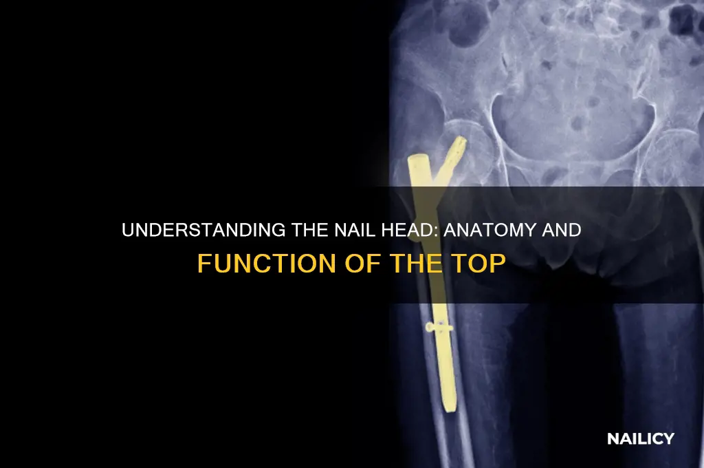 what is the top of a nail