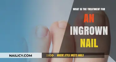 Effective Treatment Options for Painful Ingrown Nails: A Comprehensive Guide