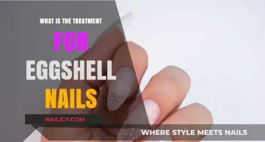 Effective Treatment Options for Fragile Eggshell Nails: A Comprehensive Guide