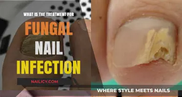 Effective Treatments for Fungal Nail Infections: Options and Solutions