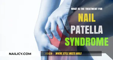 Understanding Nail Patella Syndrome: Effective Treatment Options and Management Strategies