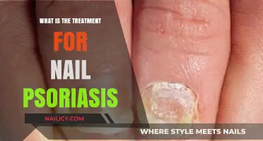 Effective Treatments for Nail Psoriasis: Relief and Management Strategies