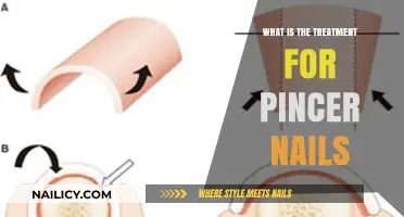 Effective Treatment Options for Painful Pincer Nails: A Comprehensive Guide