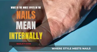 Uncover the Mystery: White Spots on Nails and Their Hidden Meanings