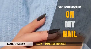 Brown Line on Nail: Causes, Concerns, and When to See a Doctor