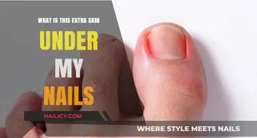 Understanding the Extra Skin Under Your Nails: Causes and Solutions
