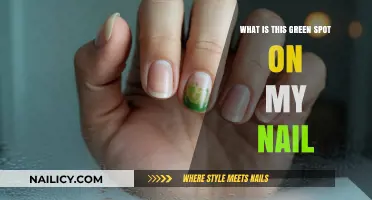 Green Spot on Nail: Causes, Concerns, and Treatment Options Explained