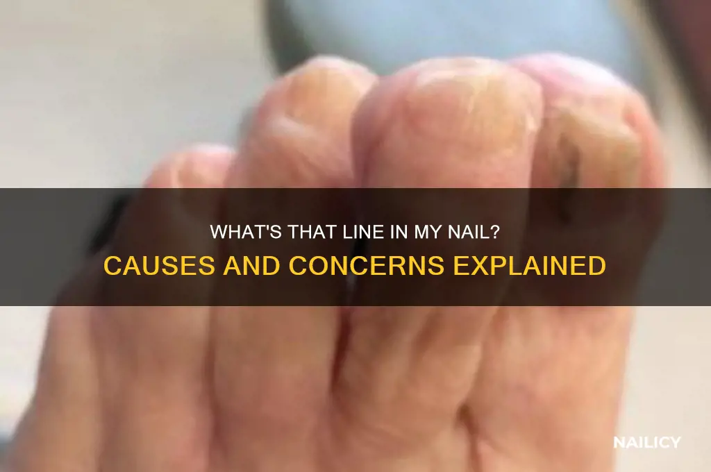 what is this line in my nail